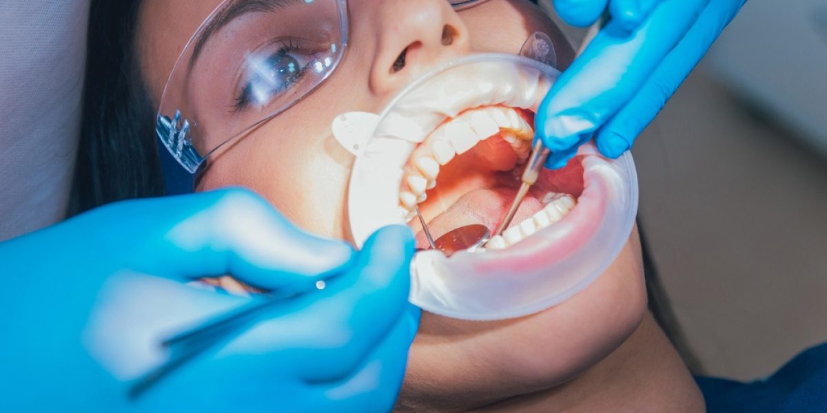 Ağız, Diş ve Çene Cerrahisi Hizmet Resim