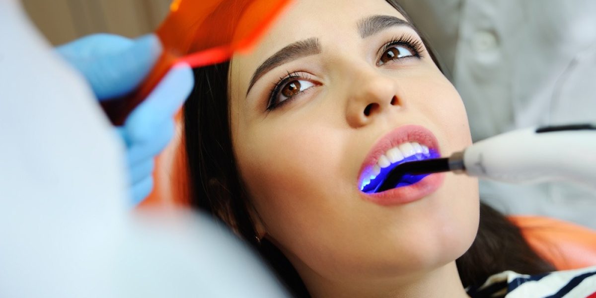 Diş Dolgusu Tedavileri Hizmet Resim